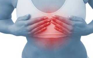 Может ли сыпь на груди у женщин быть признаком заболевания?