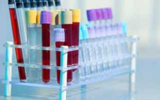 Услуга анализ крови на маркеры вирусных гепатитов – при каких болезнях и какие врачи назначают